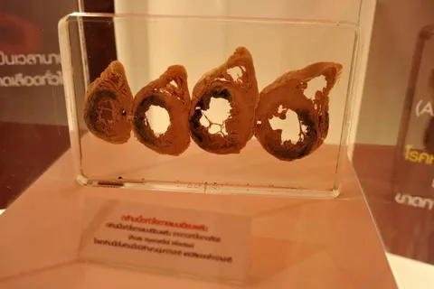 Destination: Siriraj Medical Museum — some awesome gruesomeness (NSFW) (Bangkok, Thailand) - Thailand -