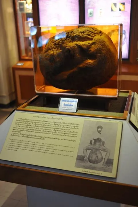 Destination: Siriraj Medical Museum — some awesome gruesomeness (NSFW) (Bangkok, Thailand) - Thailand -