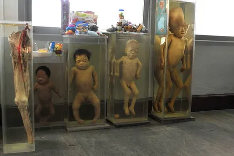 Destination: Siriraj Medical Museum — some awesome gruesomeness (NSFW) (Bangkok, Thailand) - Thailand -